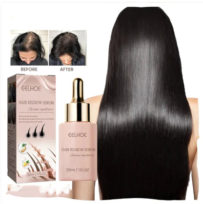 EELHOE Hair Dense Essence Hair Anti-hair Loss And Hair Fixation Nutrition